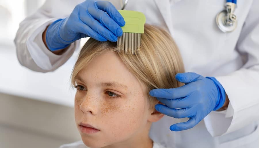Effective Treatments for Scalp Psoriasis